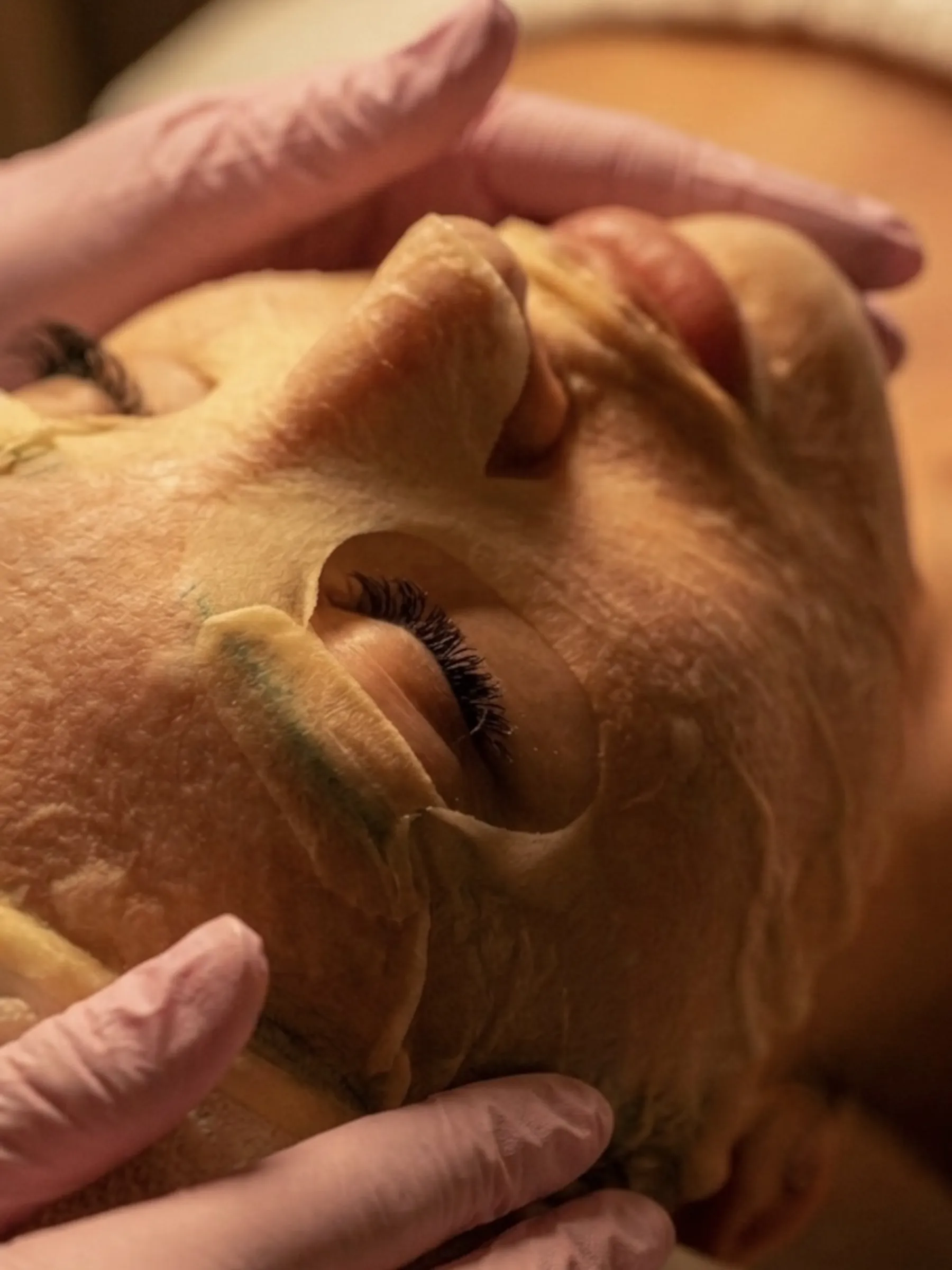 Carboxy Therapy