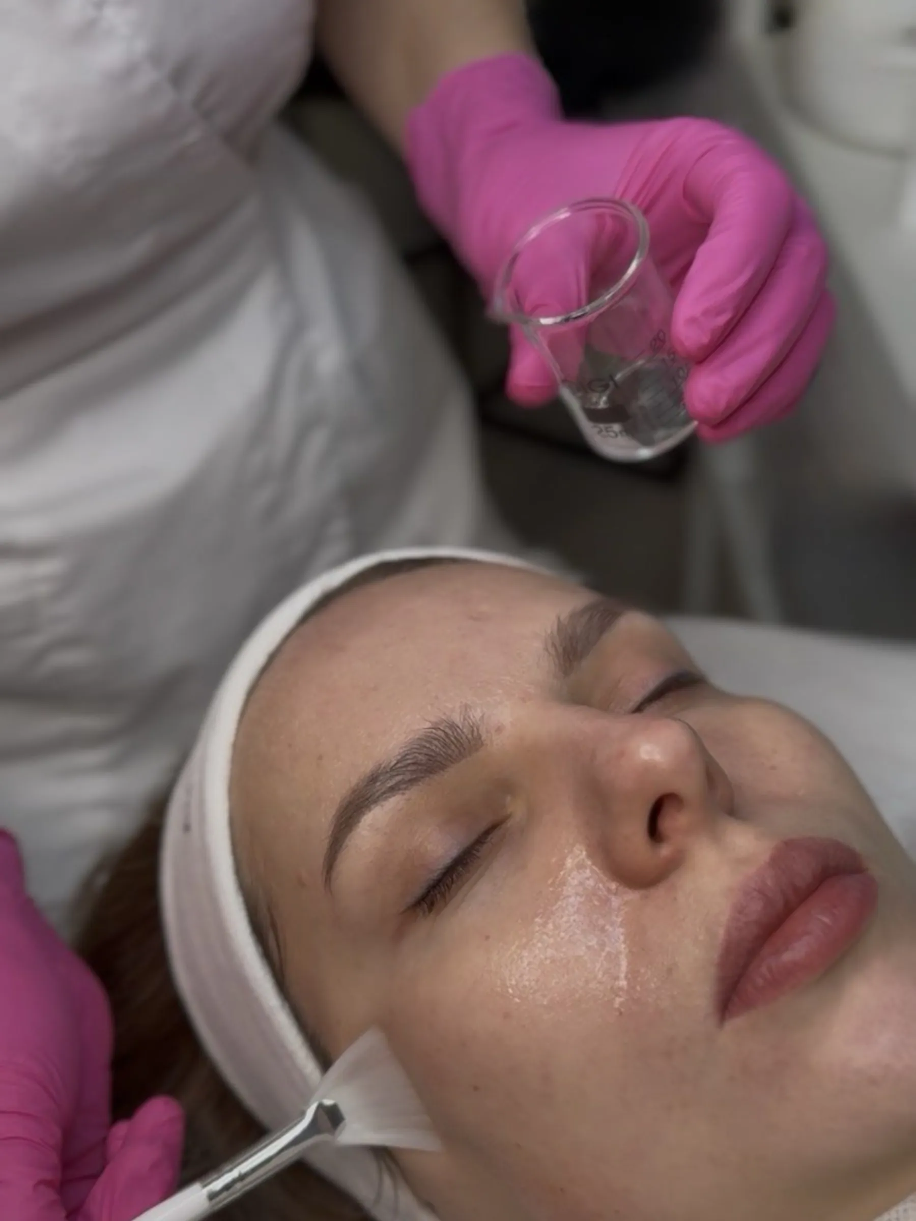 MEZOPEEL 3