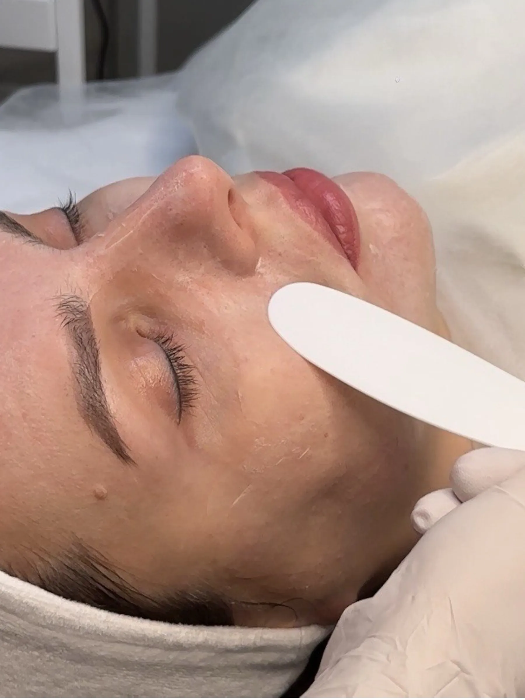 JUVENA — regenerace