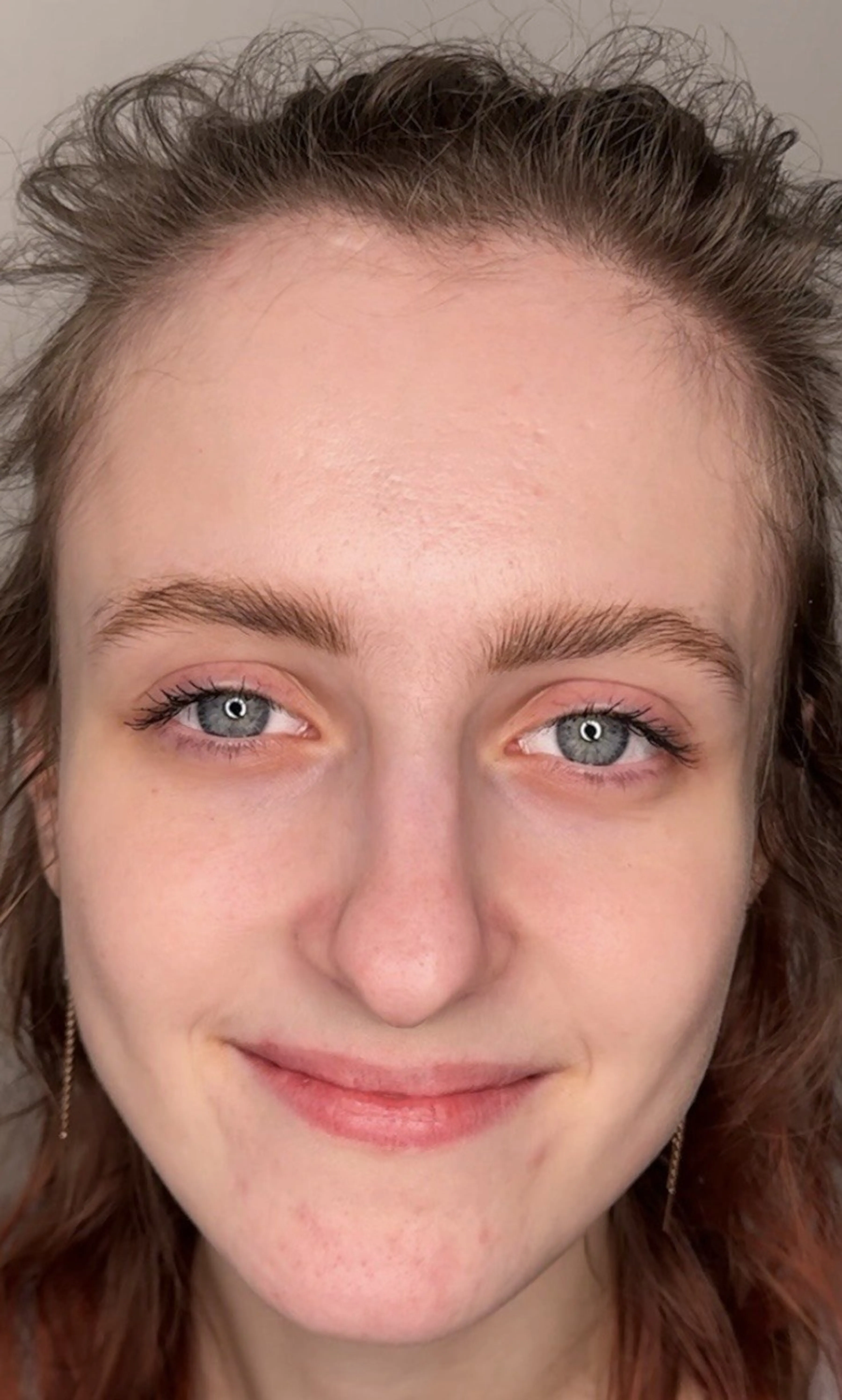 7 měsíců domácí péče a kabinetní procedury — Po