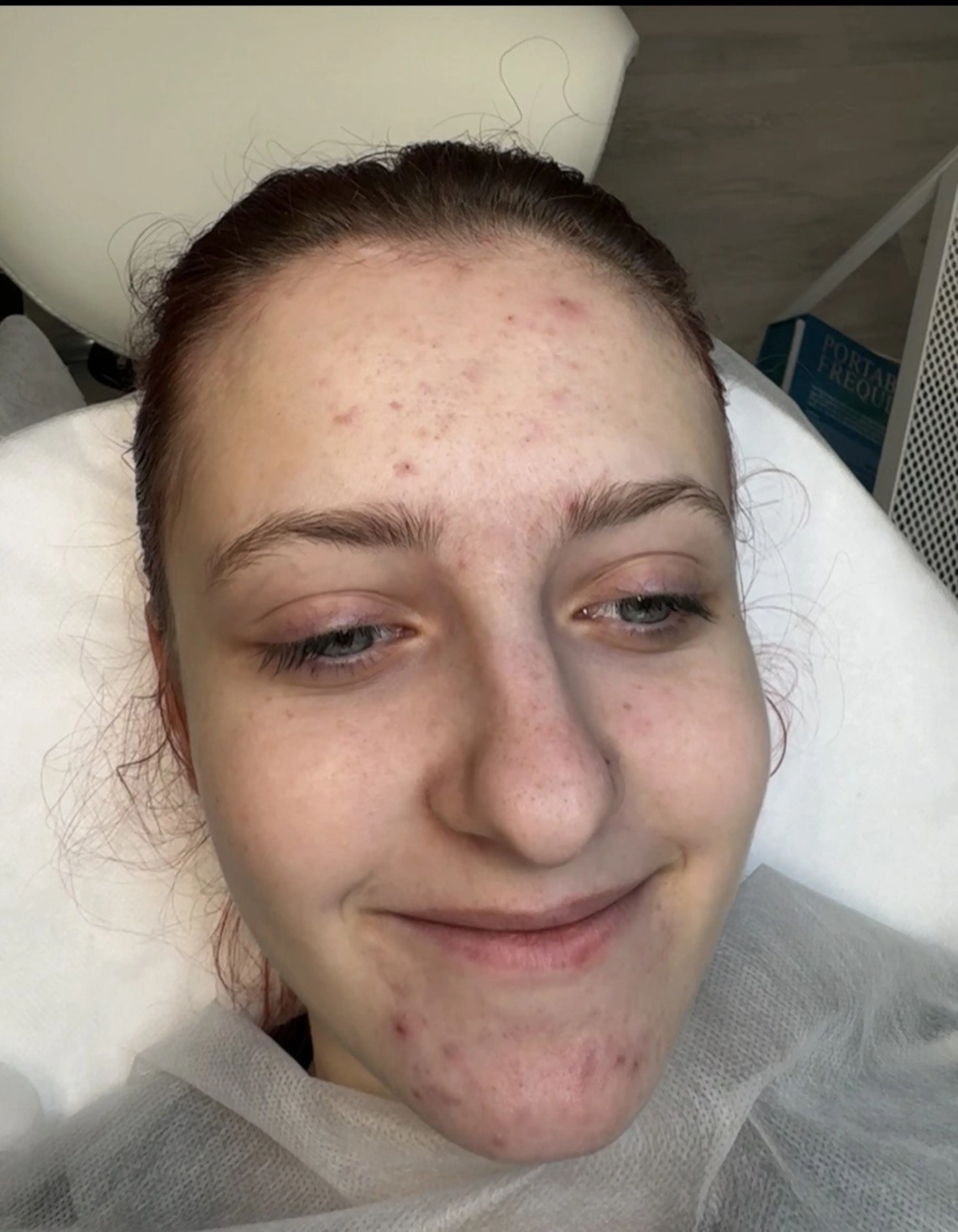 7 měsíců domácí péče a kabinetní procedury — Před